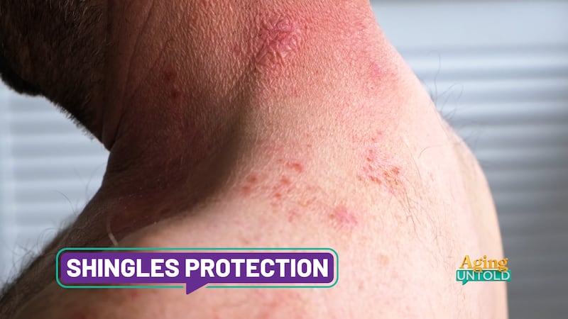 Dr. Rhea Rogers said shingles is the same virus that causes chickenpox, but it is a reactivation.